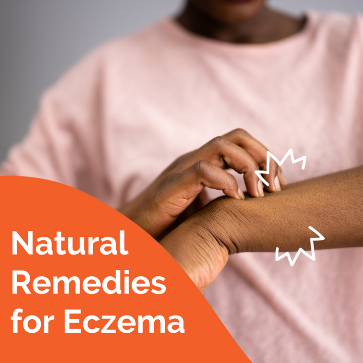 Natural Remedies for Eczema